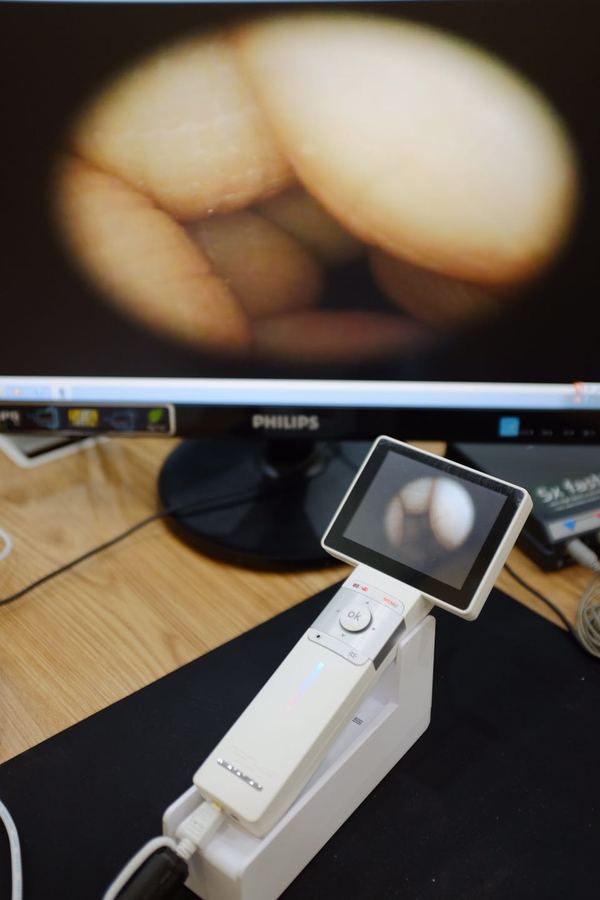 图七:最新配备的电子耳窥镜对客户的耳道检查更加细致精确.